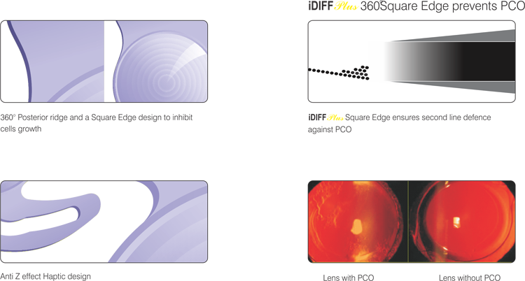 iDiff-Plus-Aspheric-IOL-1